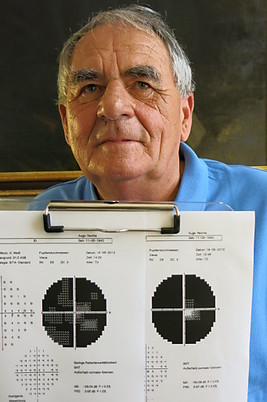 Embolie im Auge. Erblindung erfolgreich bekämpft. Embolie im Auge. Erblindung erfolgreich bekämpft.